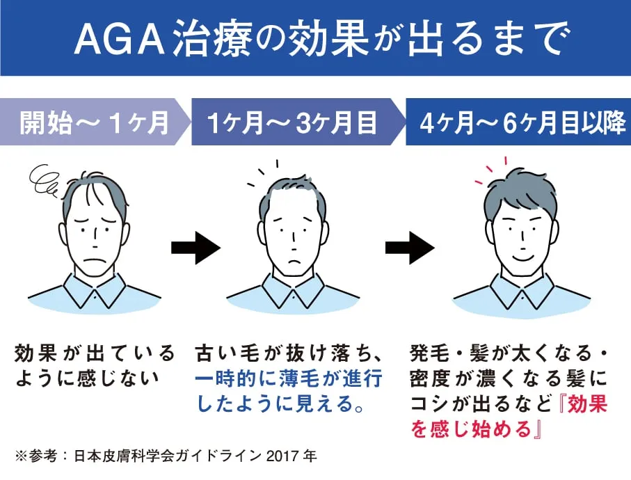 aga治療における効果の期間について