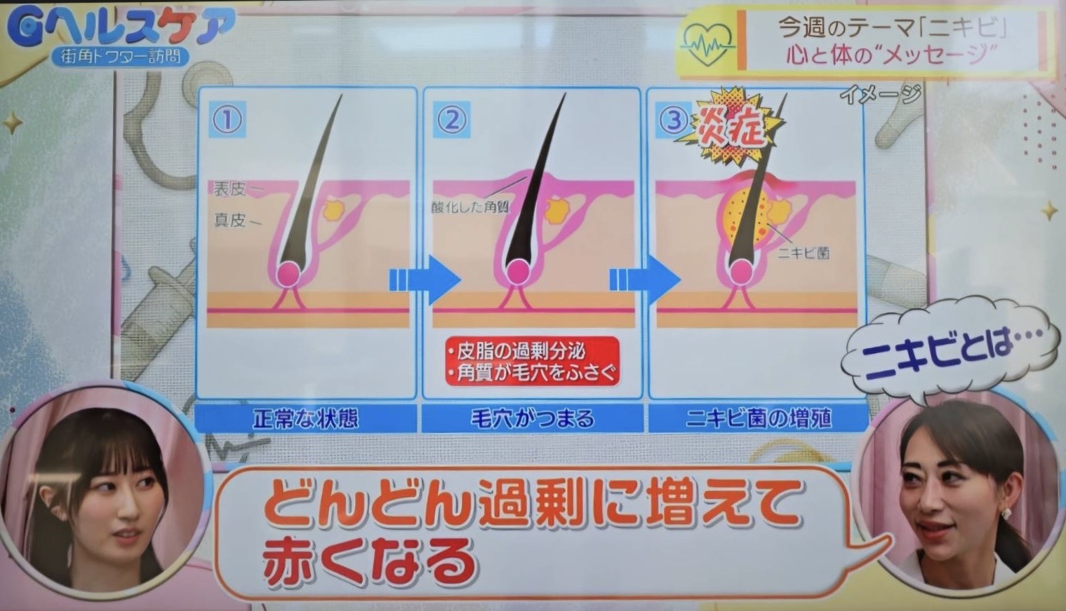 TBS Gヘルスケア