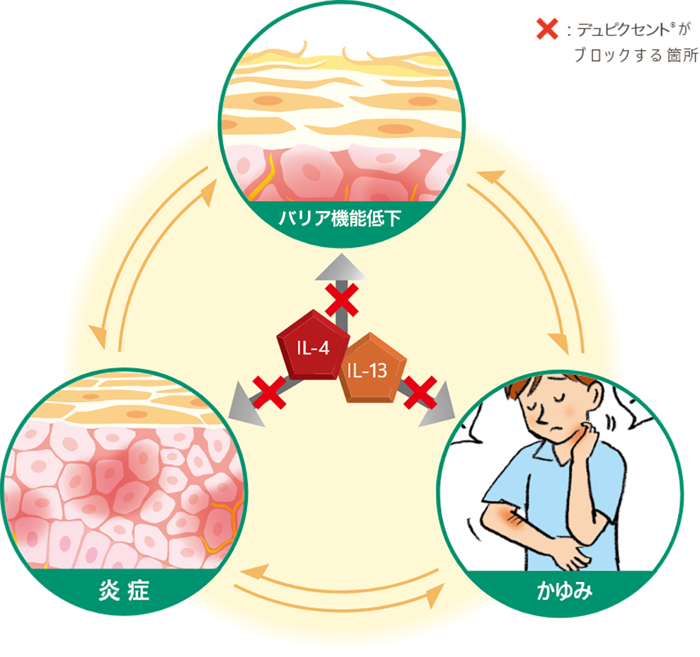 dupixent